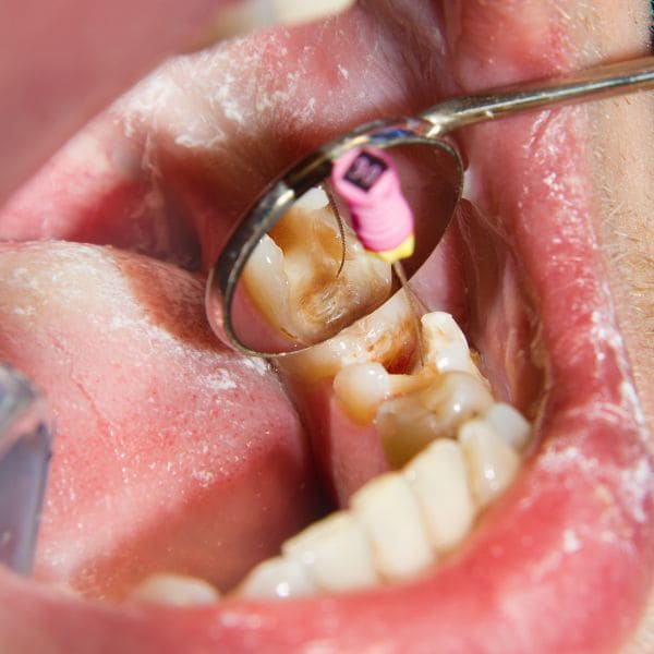 clínica dental en Huaraz